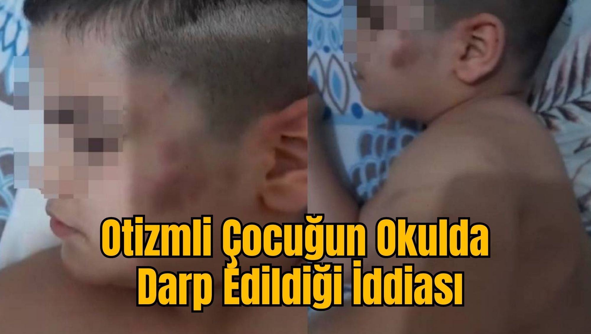 Otizmli Çocuğun Okulda Darp Edildiği İddiası