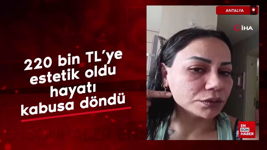 220 Bin TL'ye Estetik Oldu: Hayatı Kabusa Döndü