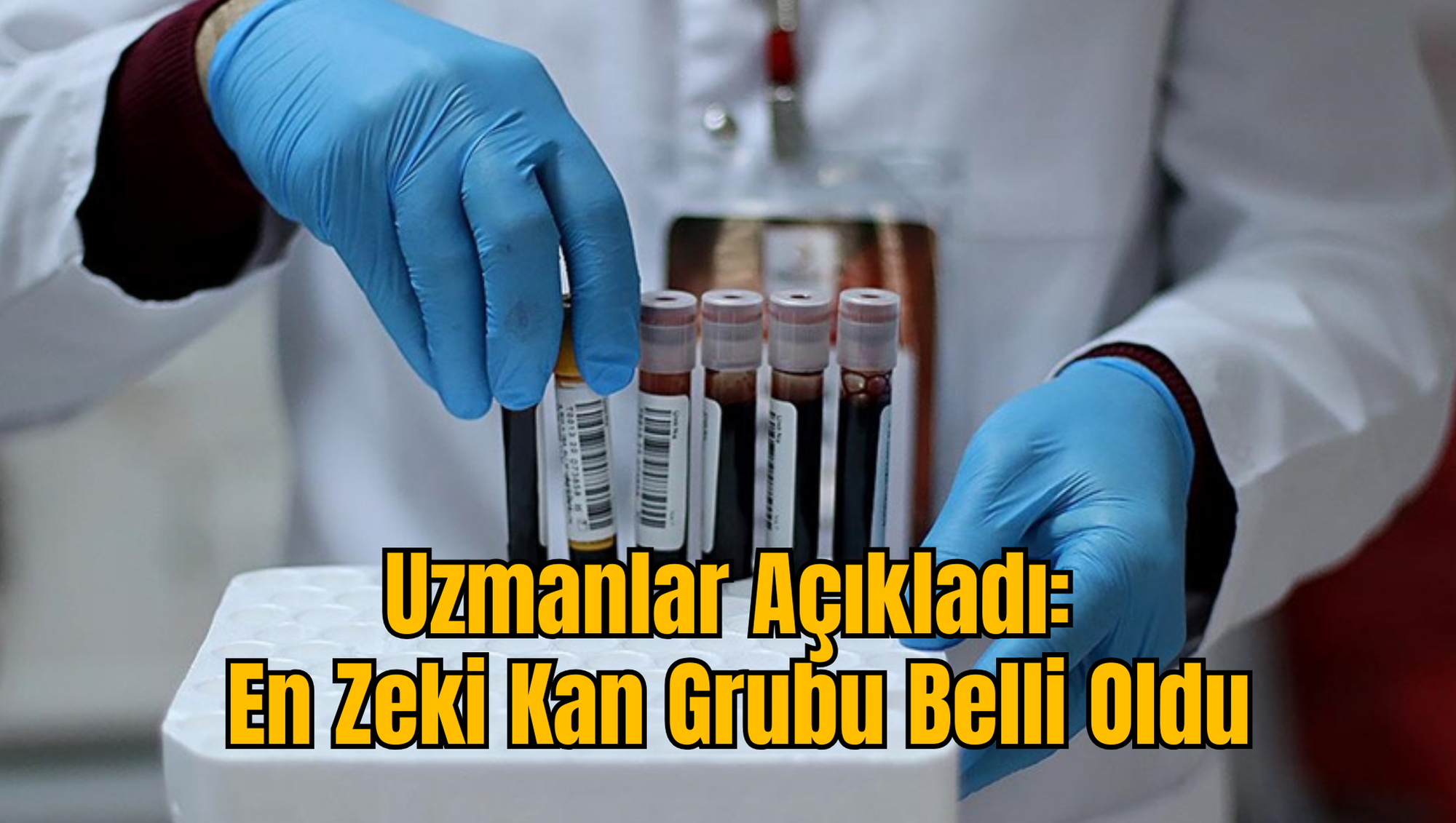 Uzmanlar Açıkladı: En Zeki Kan Grubu Belli Oldu