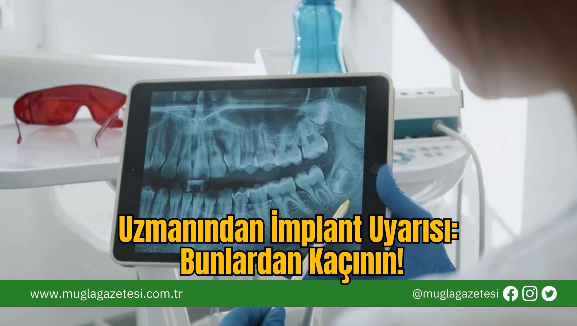 Uzmanından İmplant Uyarısı: Bunlardan Kaçının!