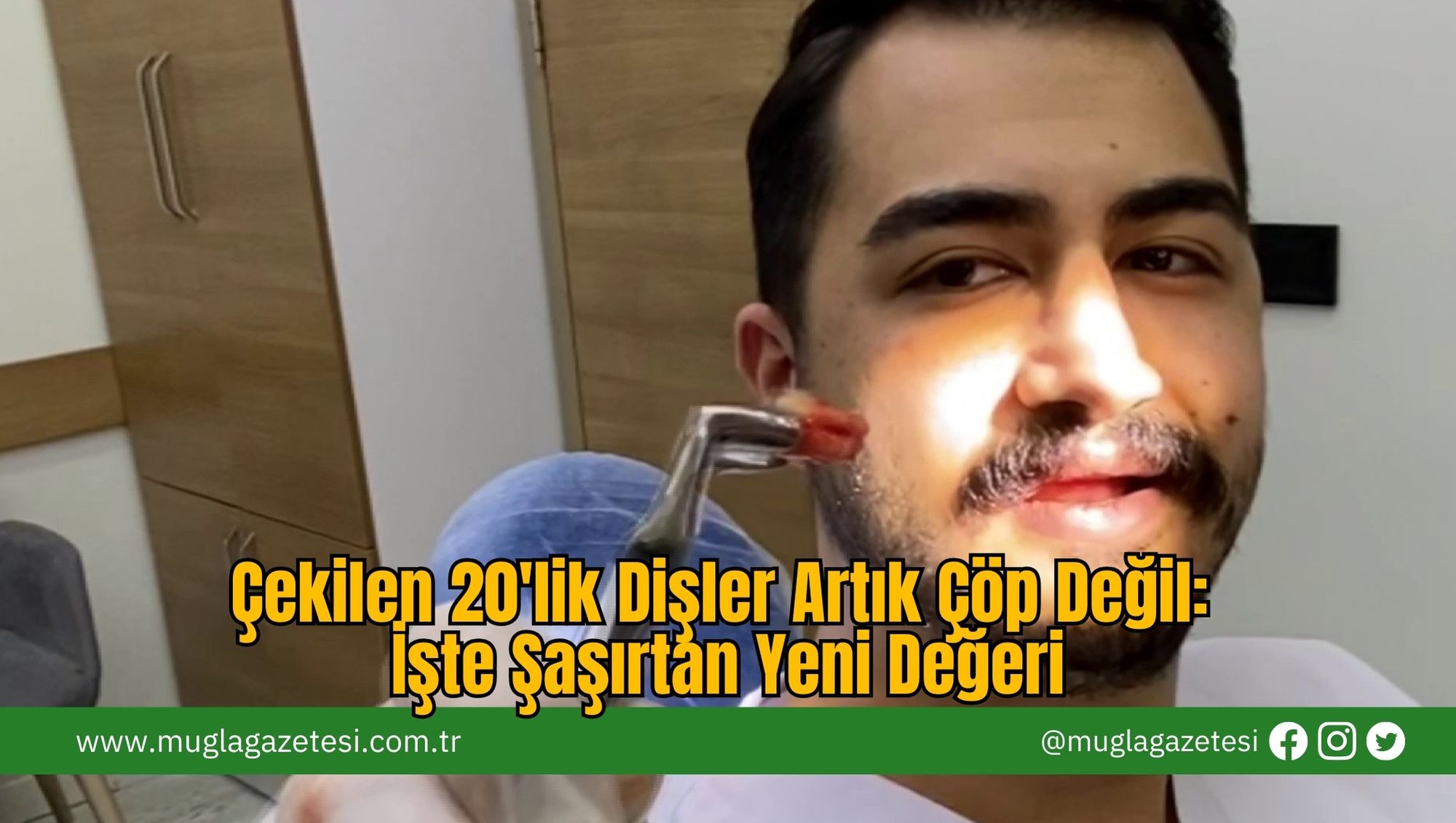 Çekilen 20'lik Dişler Artık Çöp Değil: İşte Şaşırtan Yeni Değeri