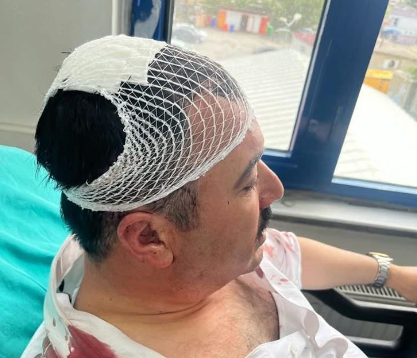 Belediye Başkan Yardımcısı Şekerlikle Darp Edildi