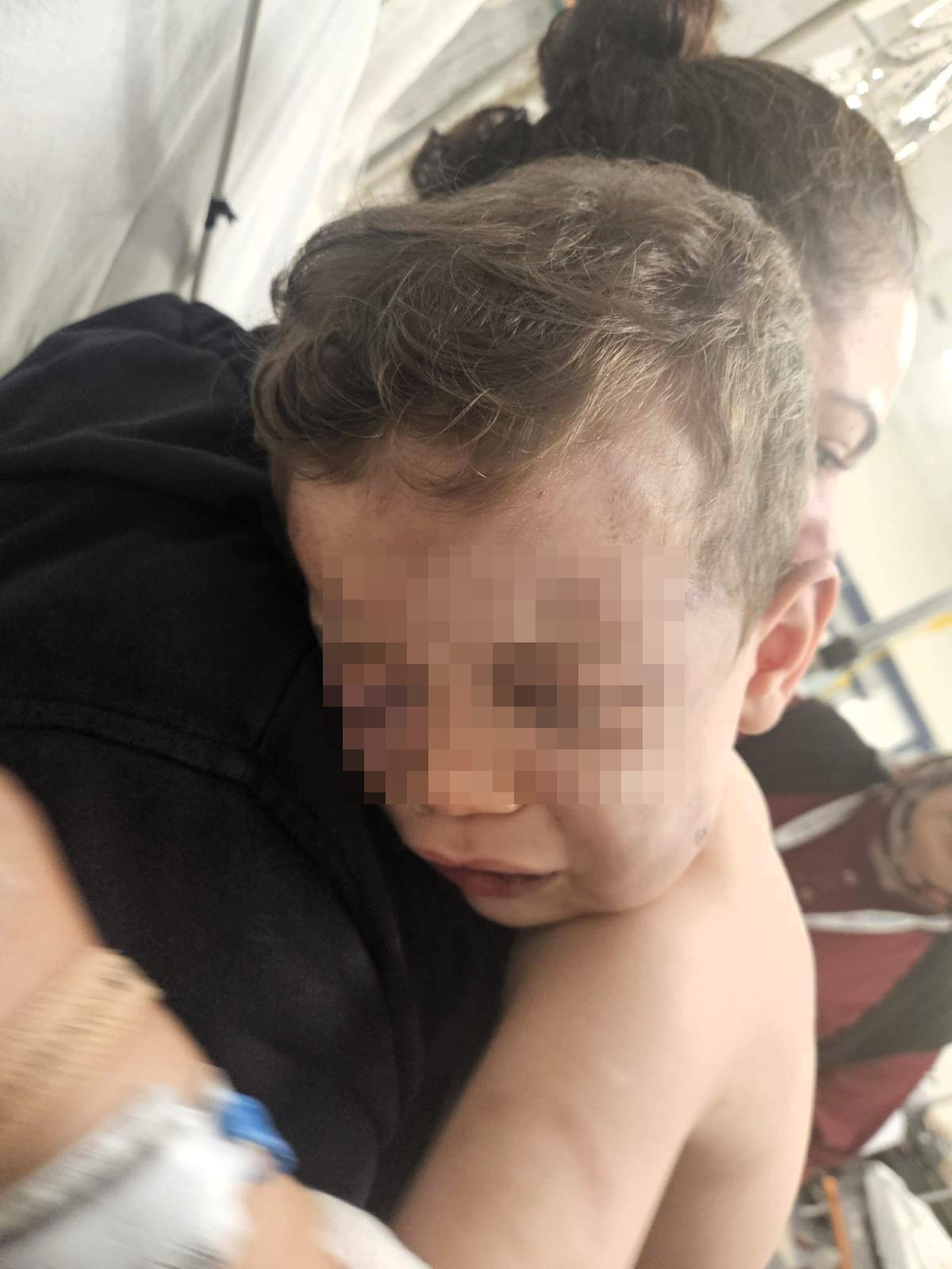 2 Yaşındaki Bebek Annesinin Sevgilisi Tarafından Darbedildi