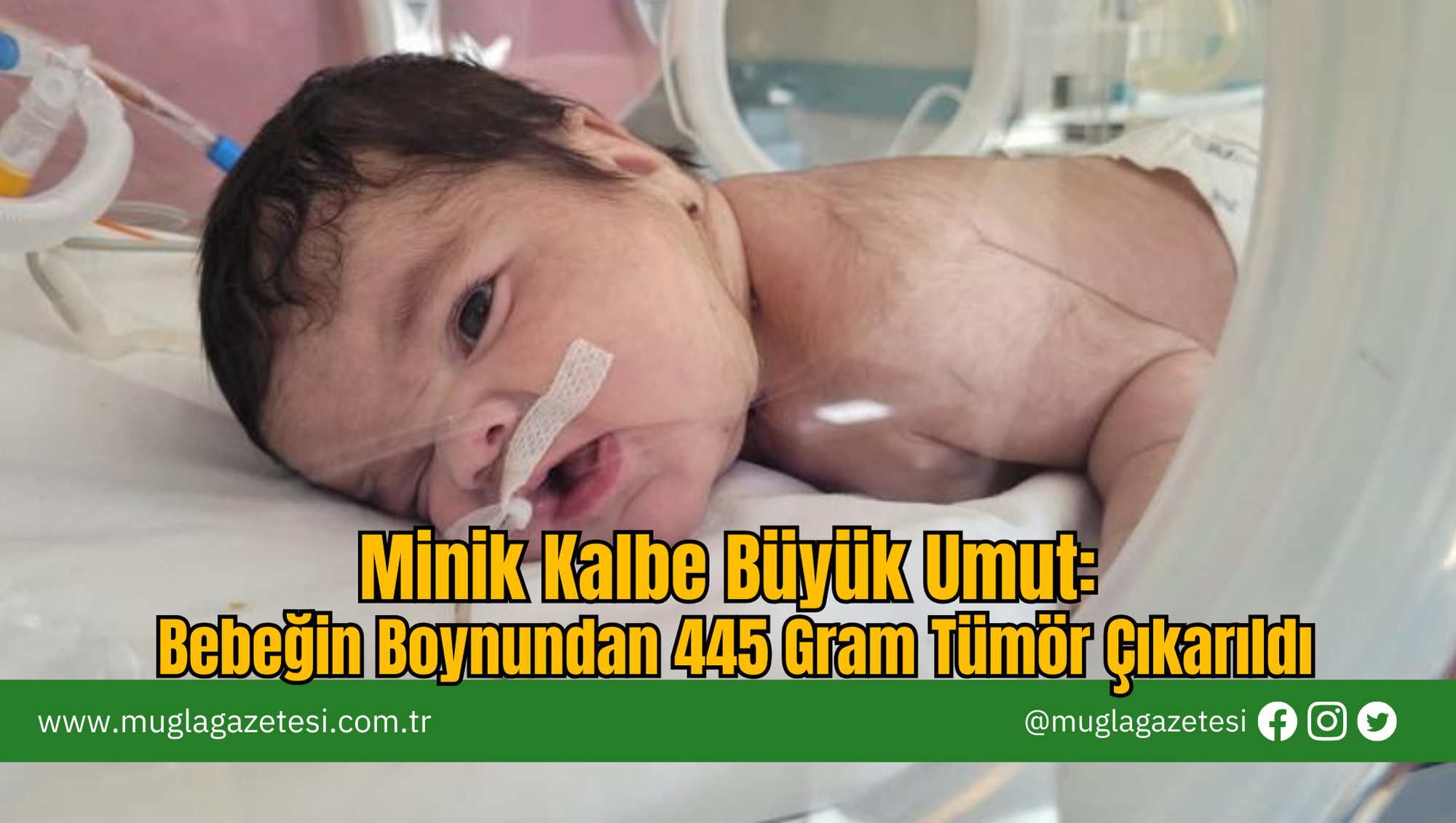 Minik Kalbe Büyük Umut: Bebeğin Boynundan 445 Gram Tümör Çıkarıldı