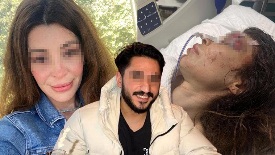 Sokak Ortasında Korkunç Olay: Boksör, Genç Kadını Hem Yumrukladı Hem Bıçakladı