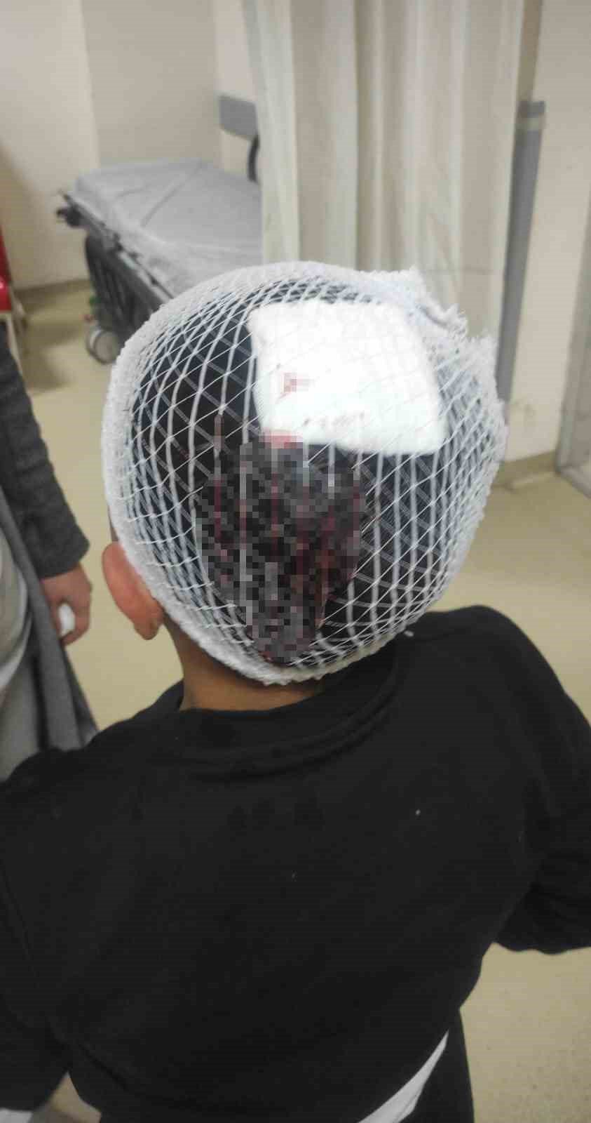 Havai Fişek: 9 Yaşındaki Çocuğun Kafasına İsabet Etti