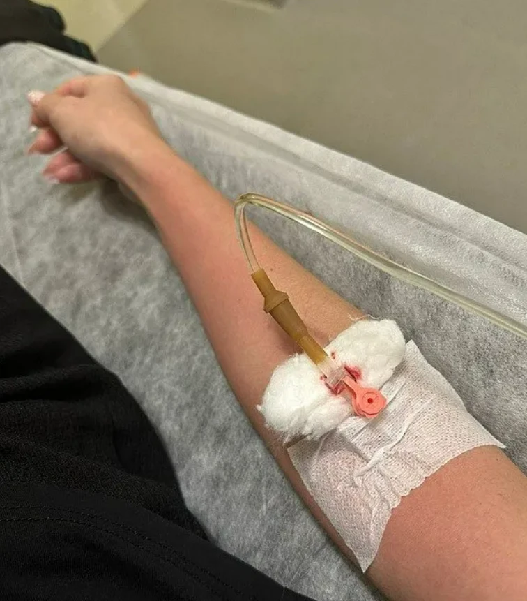 Güzelleşmek İsterken Solaryumda Unutulunca Vücudu Yandı