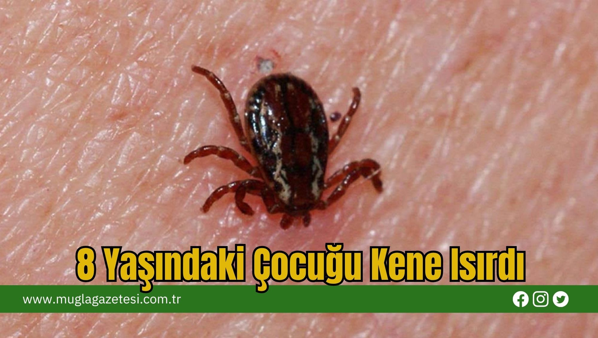 8 Yaşındaki Çocuğu Kene Isırdı