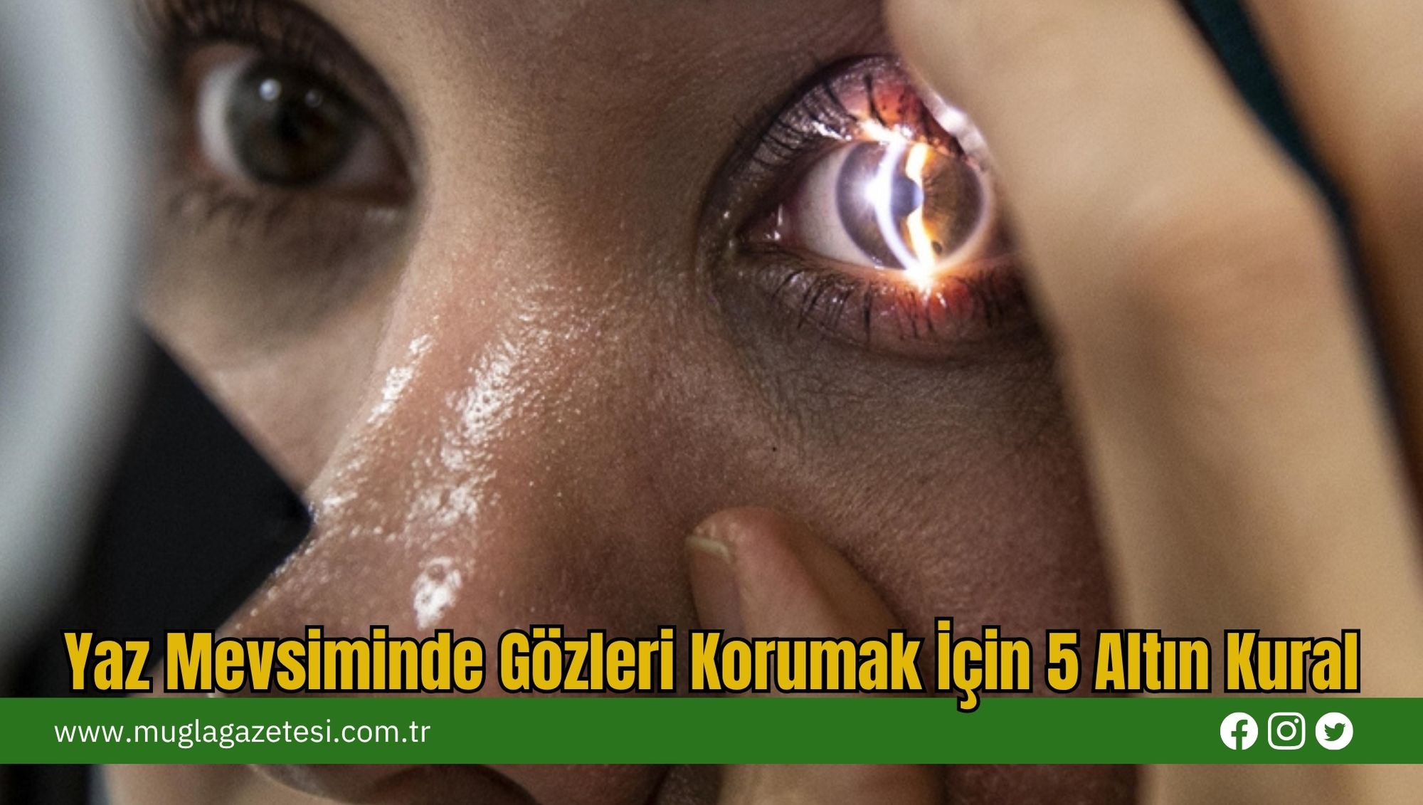 Yaz Mevsiminde Gözleri Korumak İçin 5 Altın Kural