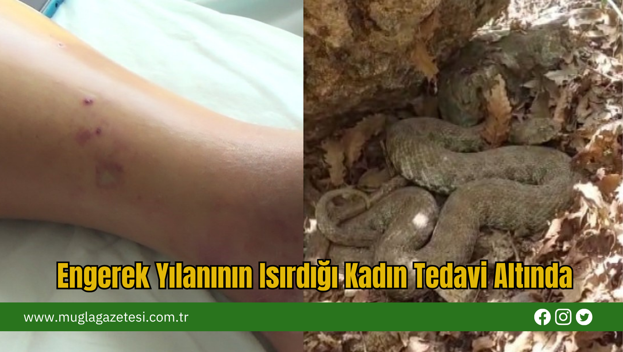 Engerek Yılanının Isırdığı Kadın Tedavi Altında