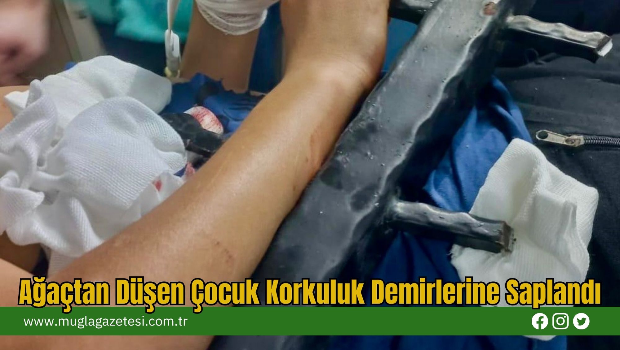 Ağaçtan Düşen Çocuk Korkuluk Demirlerine Saplandı