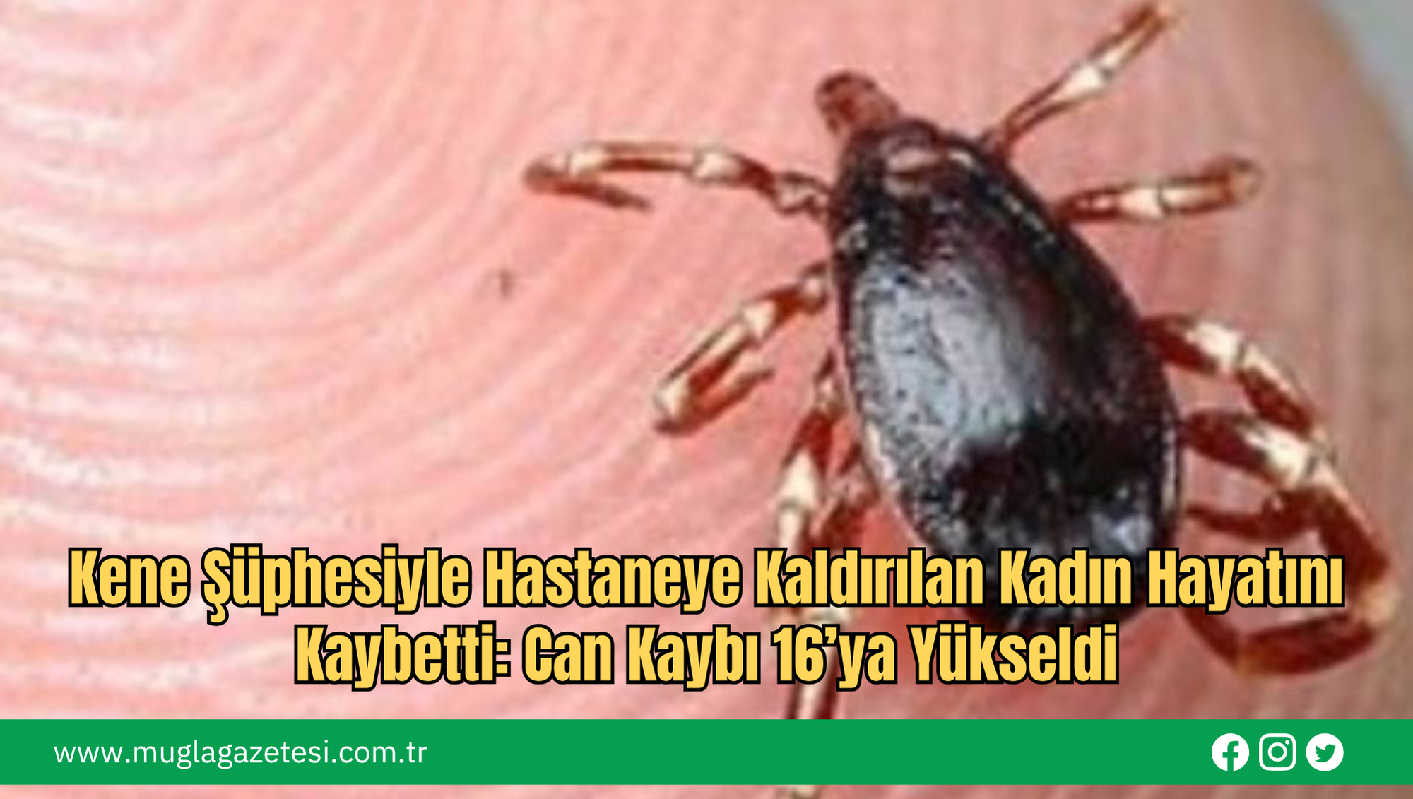 Kene Şüphesiyle Hastaneye Kaldırılan Kadın Hayatını Kaybetti: Can Kaybı 16’ya Yükseldi