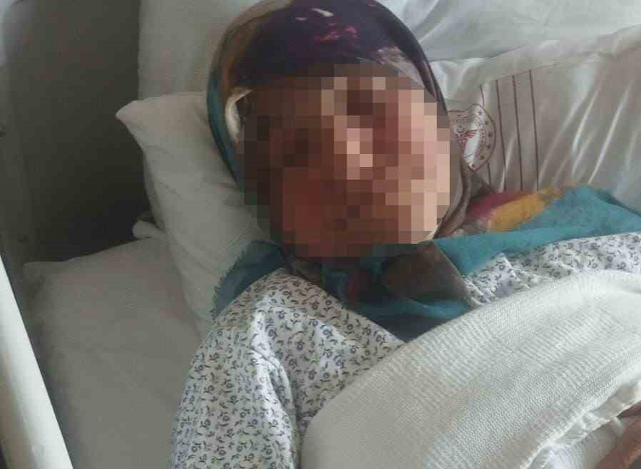 Tarlada Çalışan Yaşlı Kadına Yorgun Mermi İsabet Etti