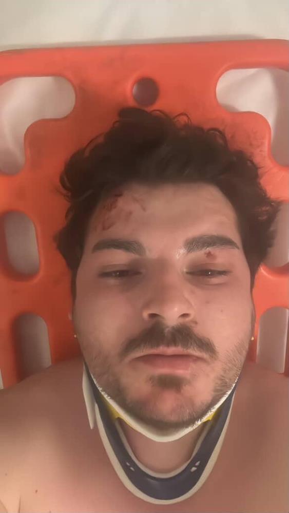 Saldırıya Uğrayan Ünlü Oyuncu Yaşadıklarını Paylaştı: 