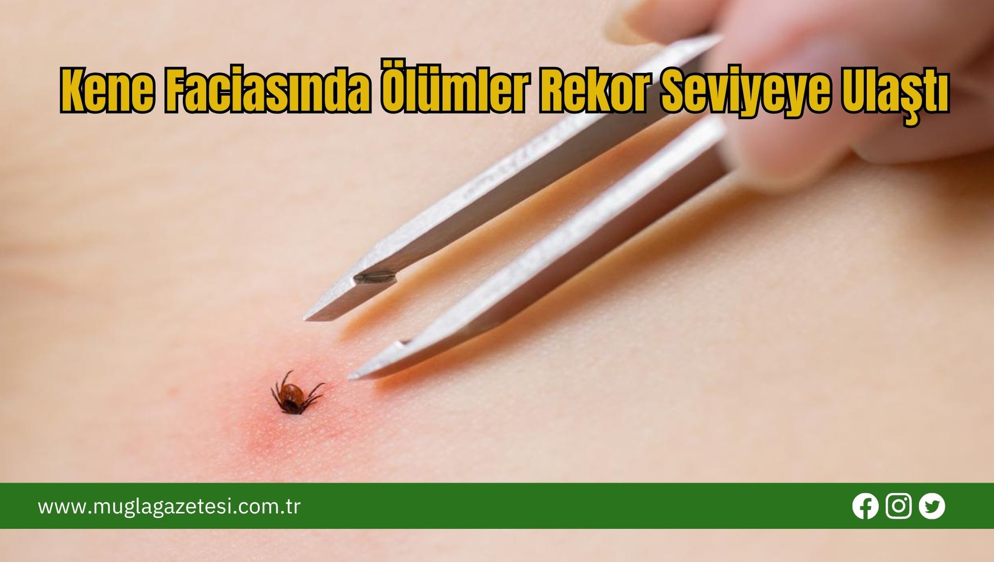 Kene Faciasında Ölümler Rekor Seviyeye Ulaştı