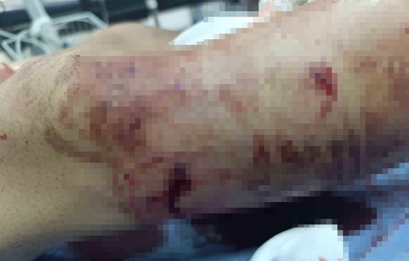 İneklerini Otlattığı Sırada Ayı Saldırısına Uğrayan Çocuk Yaralandı