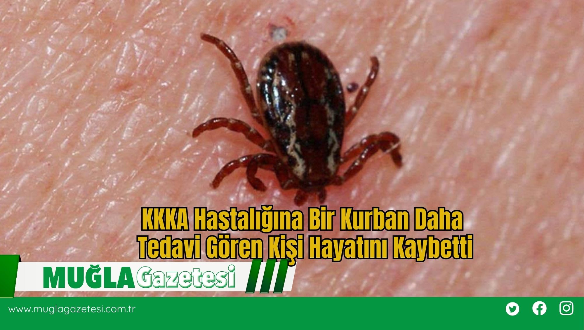 KKKA Hastalığına Bir Kurban Daha  Tedavi Gören Kişi Hayatını Kaybetti