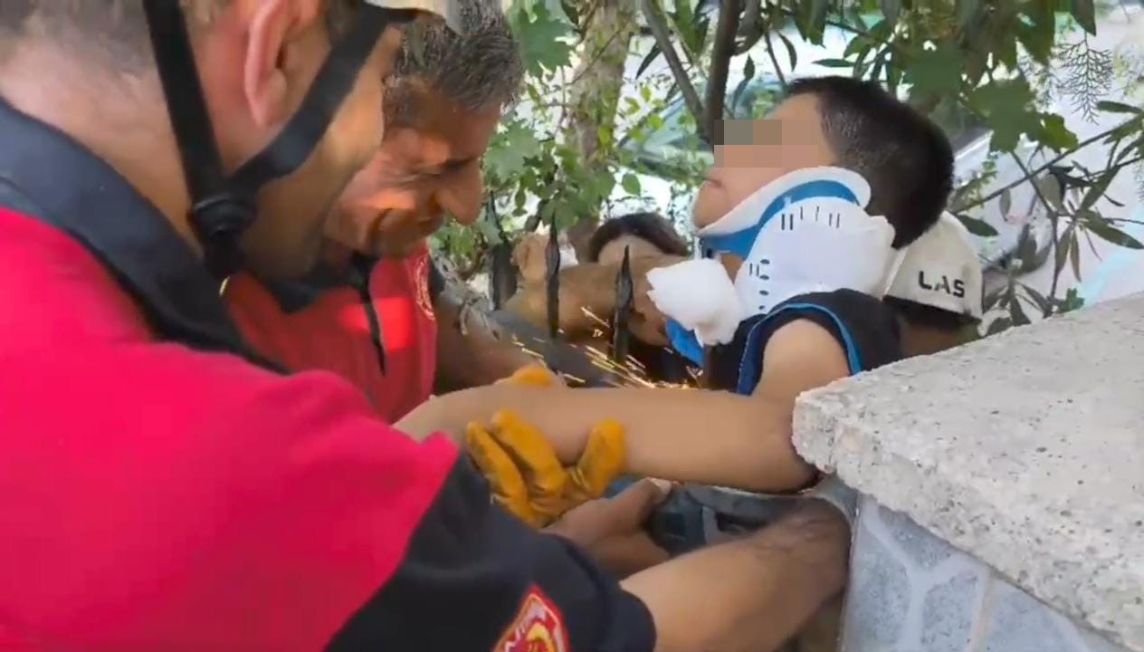 Demir Korkuluk Küçük Çocuğun Koluna Saplandı