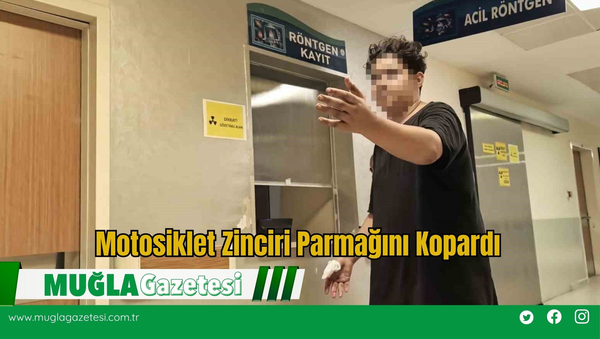 Motosiklet Zinciri Parmağını Kopardı
