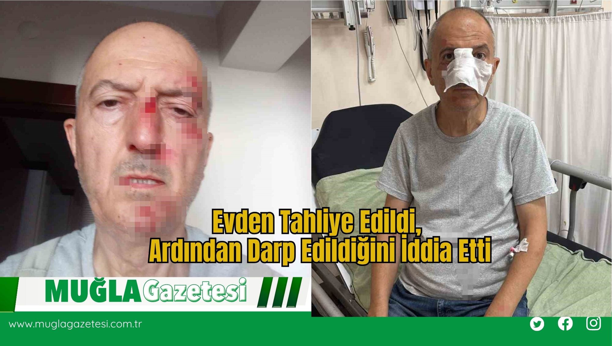 Evden Tahliye Edildi, Ardından Darp Edildiğini İddia Etti