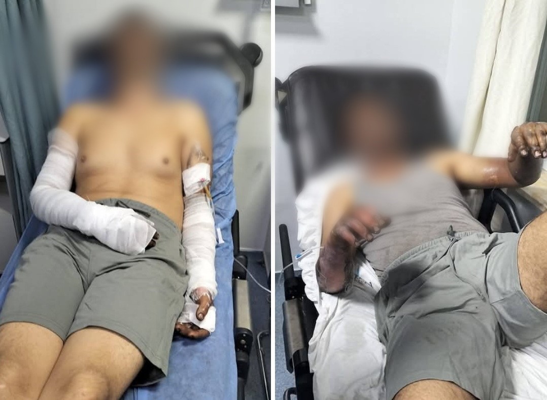 Sanayi Sitesinde Patlama: İki İşçi Yaralandı