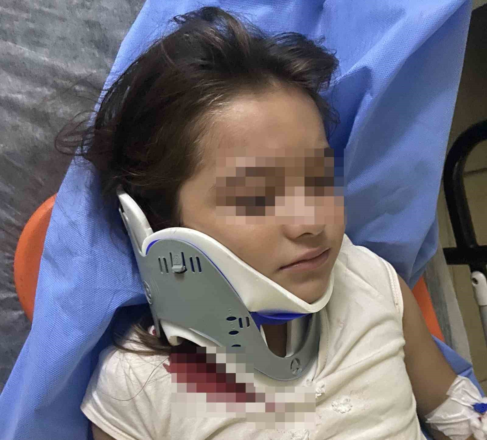 Scooter Kazası: Ters Yönden Gelen Sürücü Küçük Kıza Çarptı