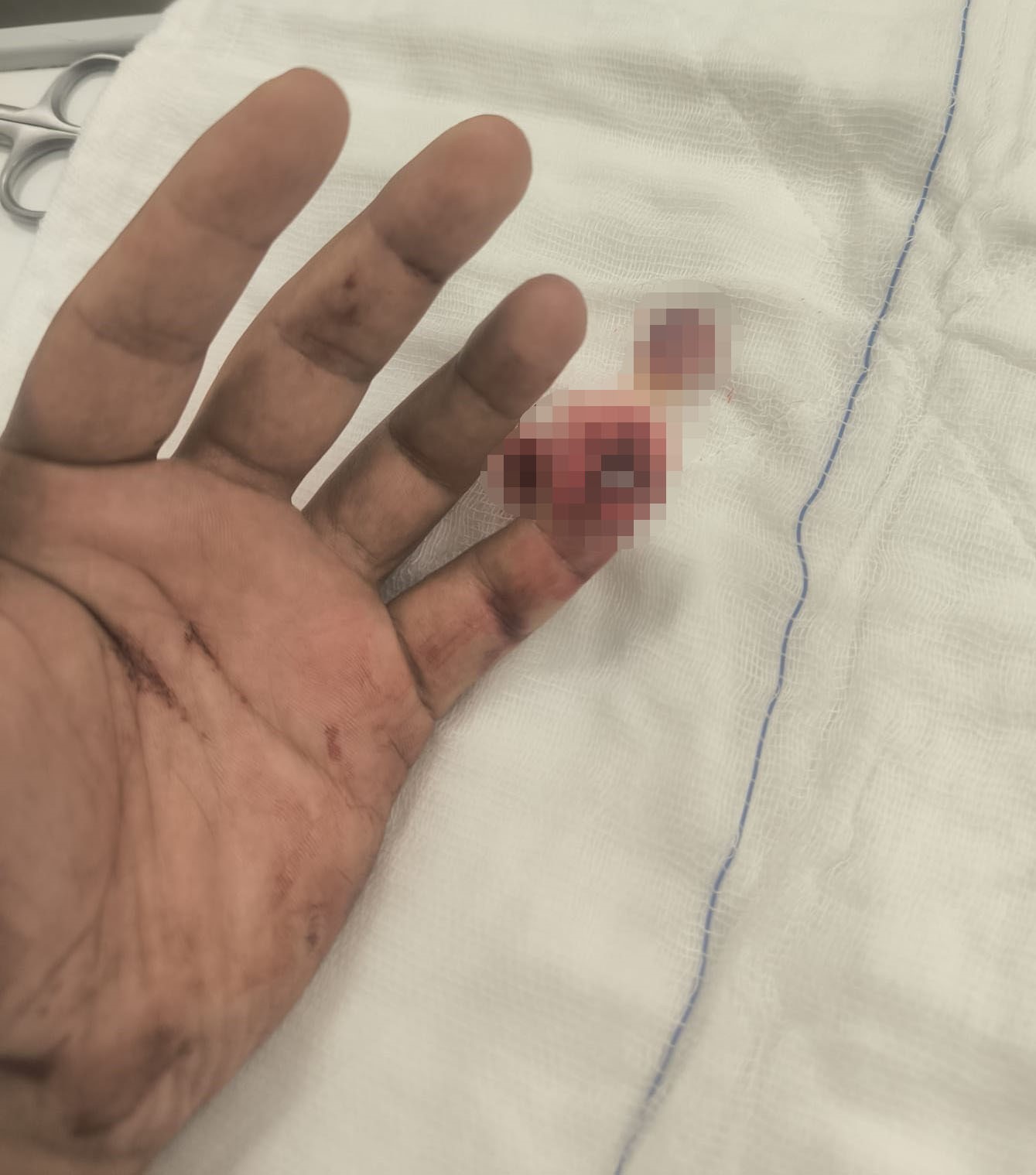 Şüpheli Direndi: Polis Memurunun Parmağını Isırarak Kopardı