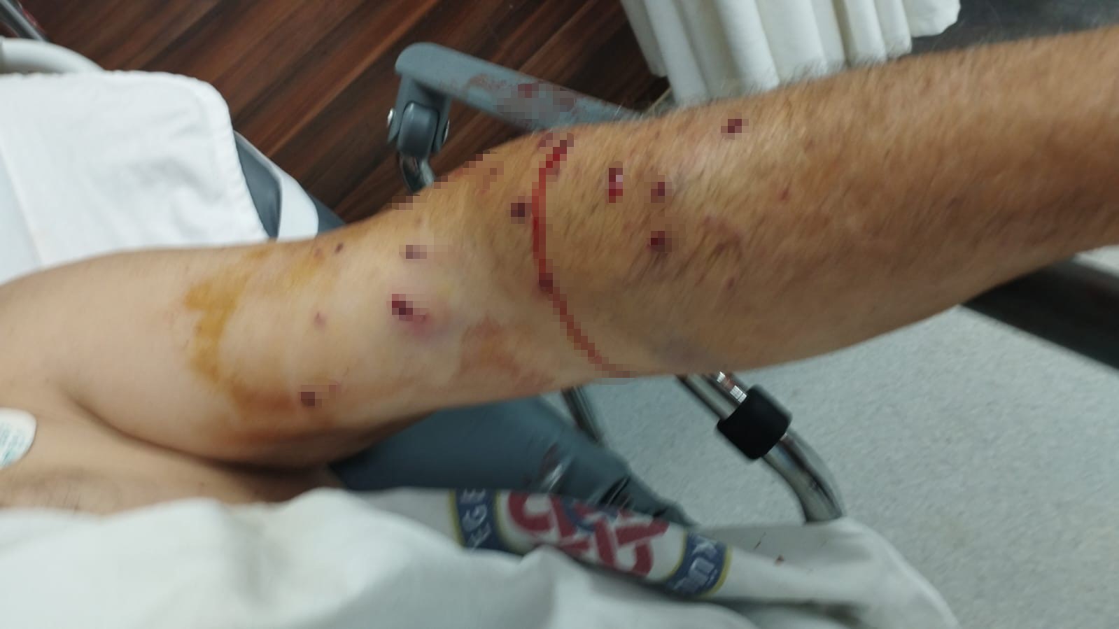 Akılalmaz Olay: 180 Lira İçin Çalışanı Vurdu