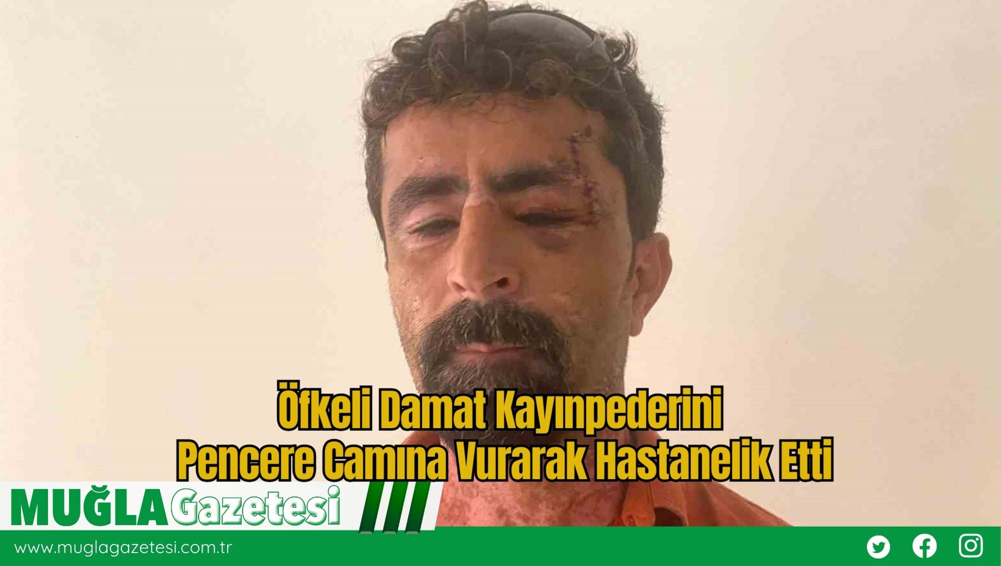 Öfkeli Damat Kayınpederini Pencere Camına Vurarak Hastanelik Etti