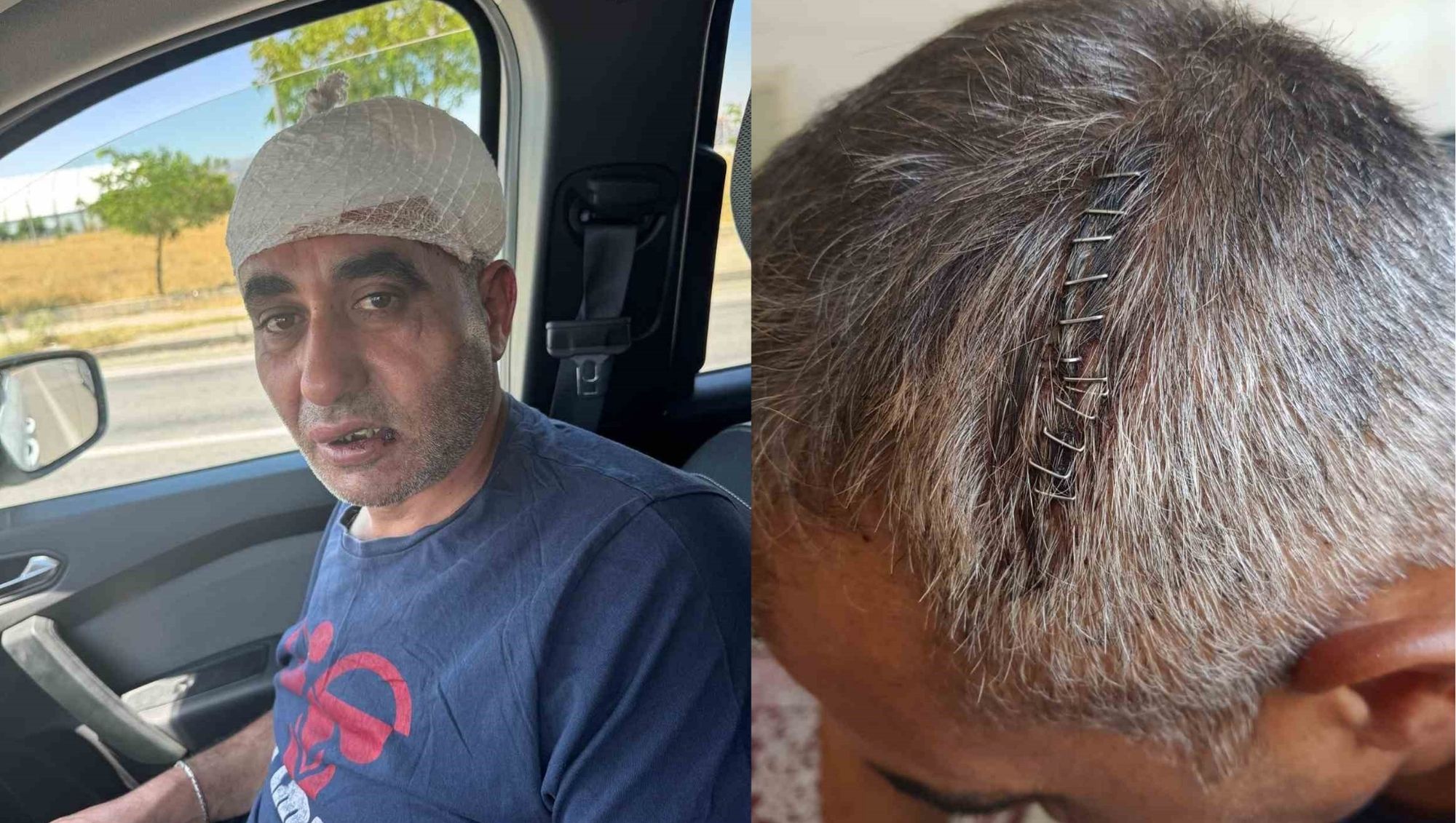 Öldüresiye Dayak İddiası: Eğlence Merkezi Çıkışında Kanlar İçinde Kaldı