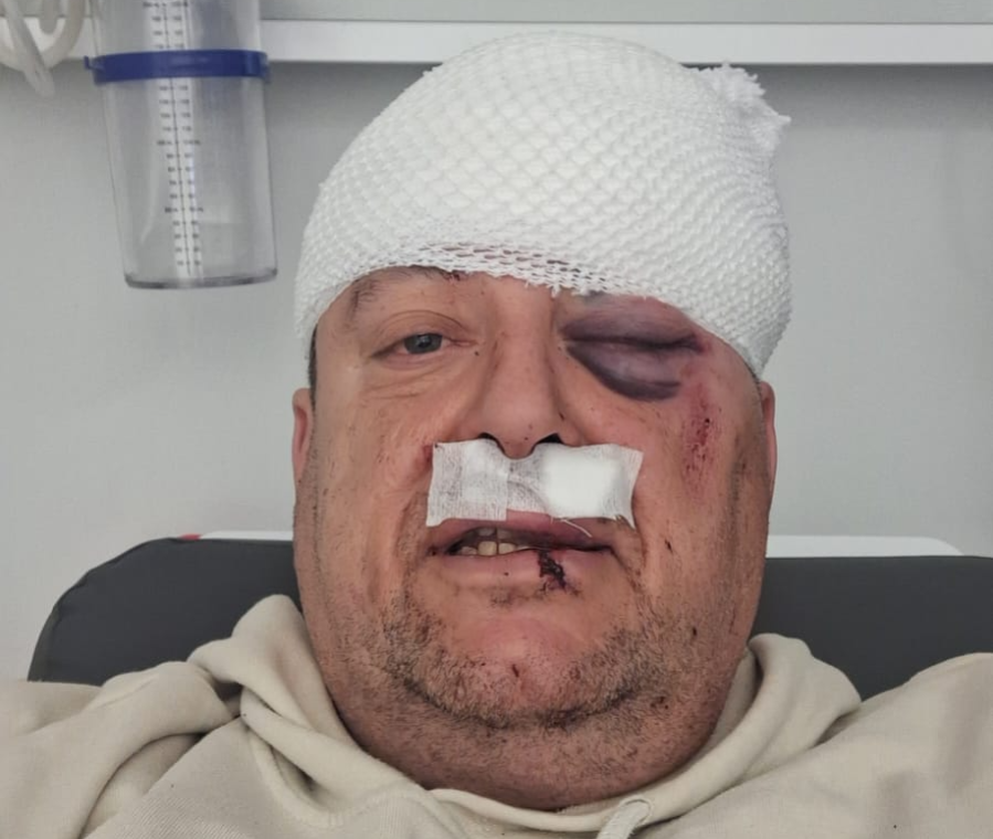 Marmaris’te Gazeteciye Saldırıda Şok Gelişme