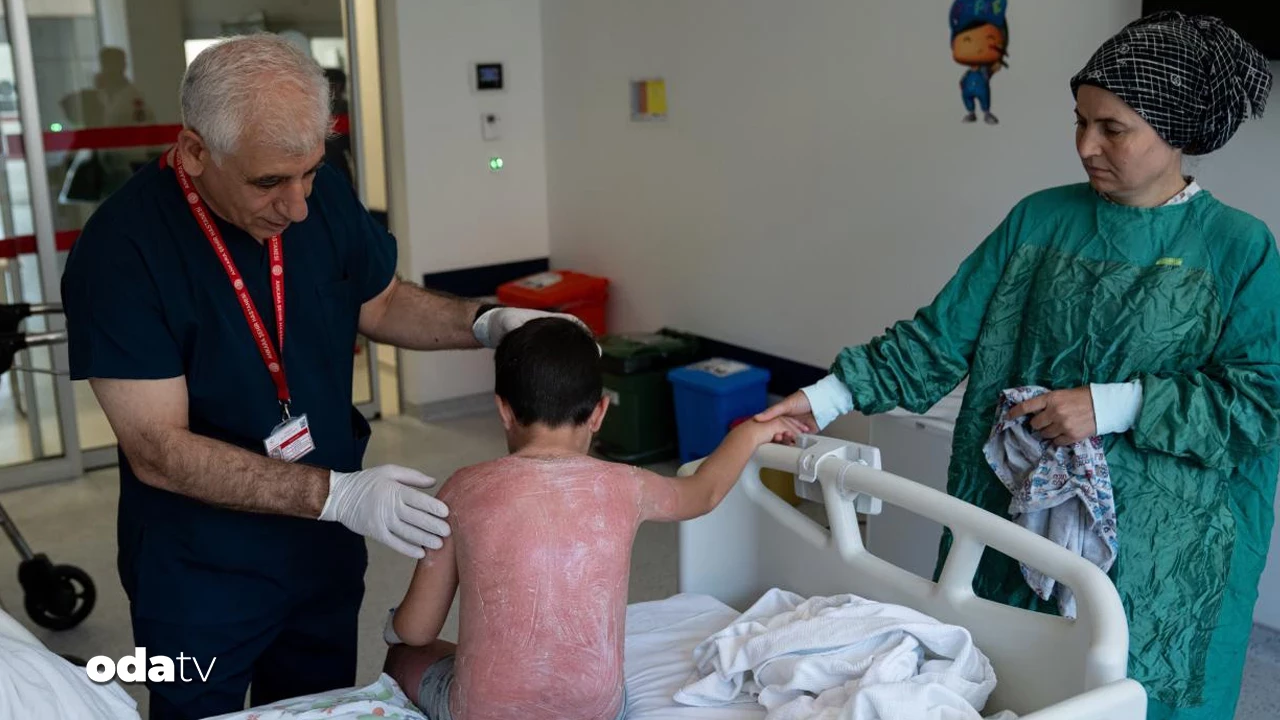 4 Saat Güneşte Kalan Çocuk, İkinci Derece Yanıkla Hastanelik Oldu