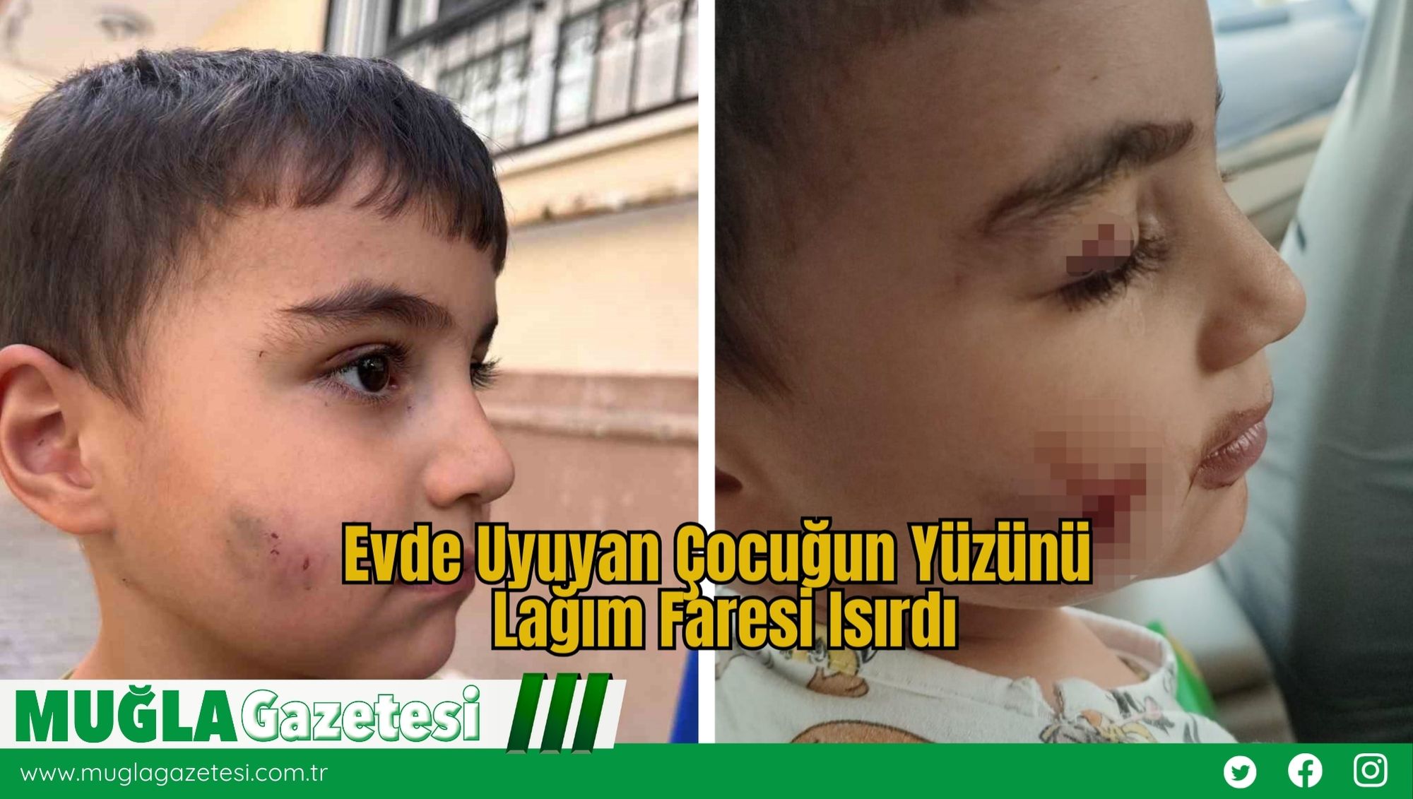 Evde Uyuyan Çocuğun Yüzünü Lağım Faresi Isırdı