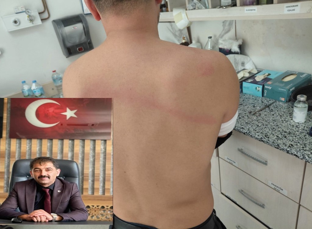 Zabıta Memurunu Sopayla Döven Belediye Başkanının Yeni Skandalları Ortaya Çıktı