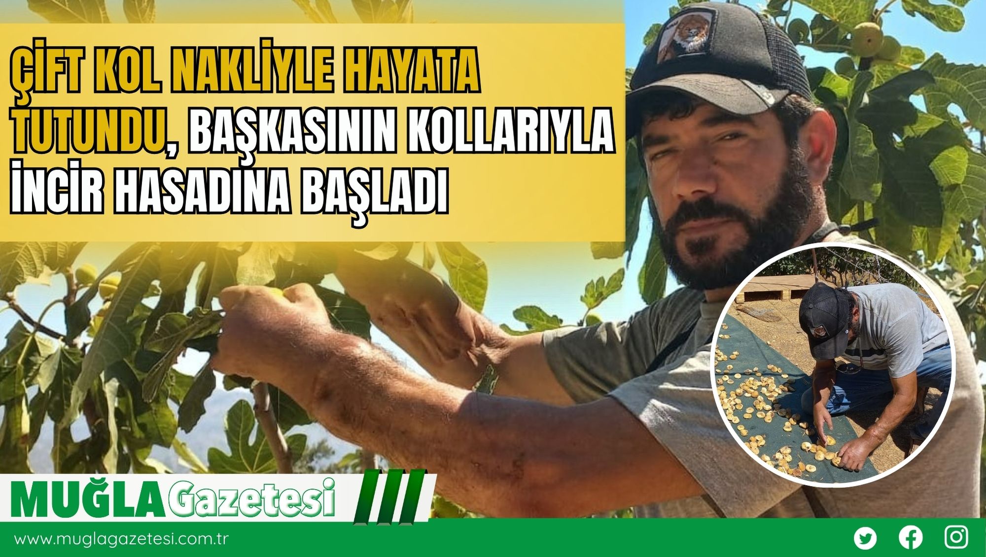 Çift Kol Nakliyle Hayata Tutudu, Başkasının Kollarıyla İncir Hasadına Başladı