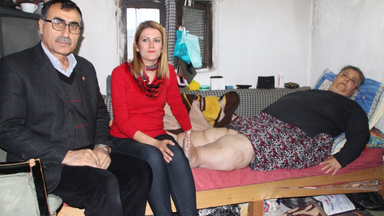 Fethiye'de fil hastası kadının dramı yürek burkuyor