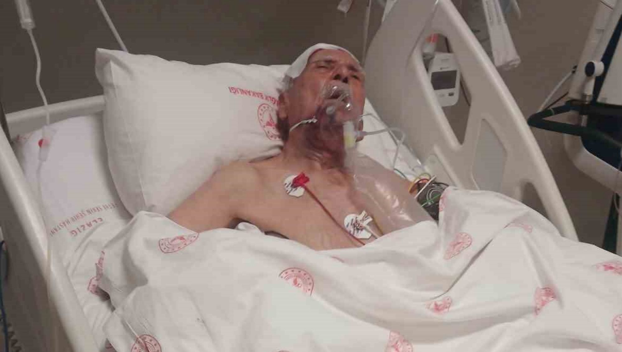 Yarım Saat Ara ile İki Kez Otomobil Çarptı, Yaşlı Adam Hayatını Kaybetti