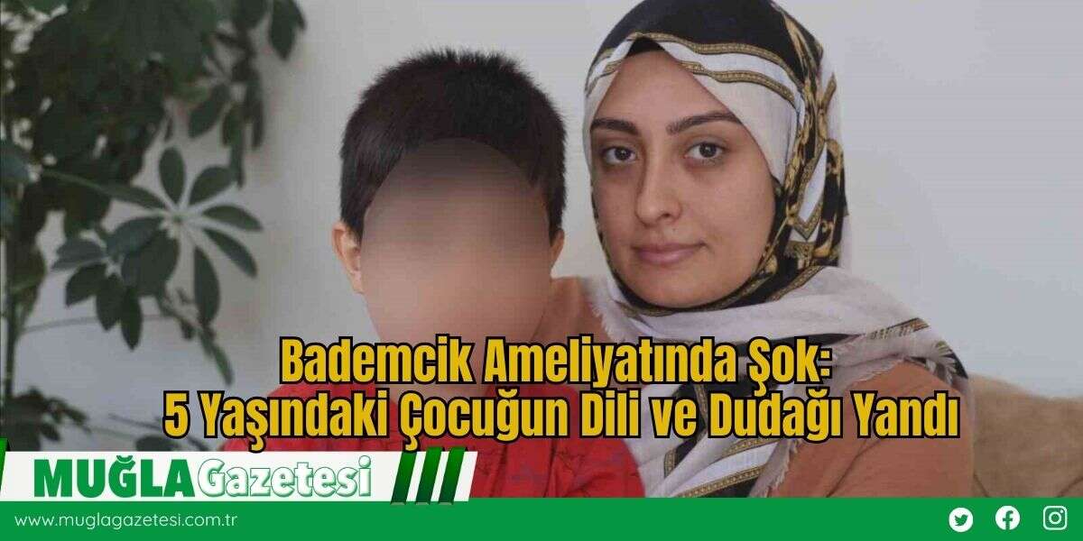 Bademcik Ameliyatında Şok: 5 Yaşındaki Çocuğun Dili ve Dudağı Yandı