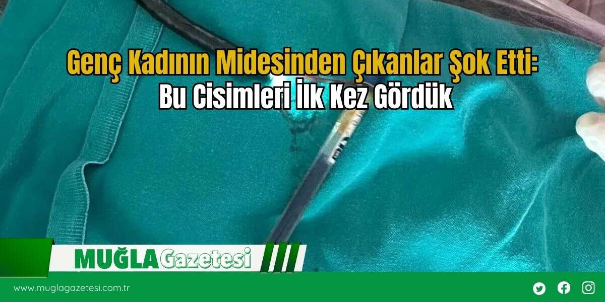 Genç Kadının Midesinden Çıkanlar Şok Etti: Bu Cisimleri İlk Kez Gördük