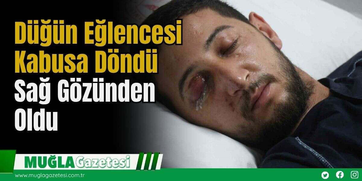 Düğün Eğlencesi Kabusa Döndü: Sağ Gözünden Oldu