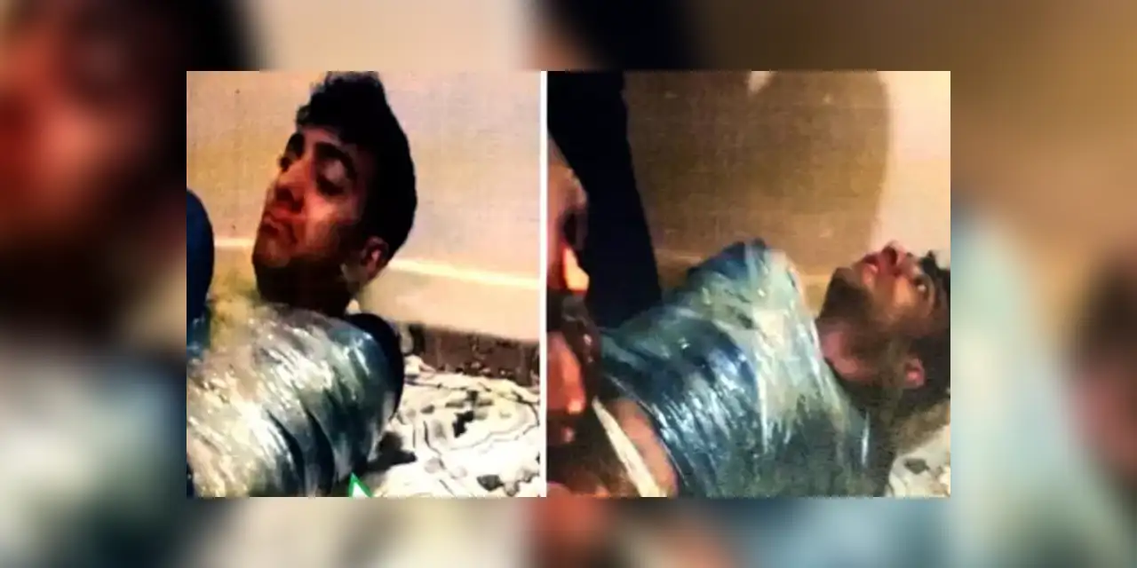 Akılalmaz İşkence! 20 Kişi Linç Etti: "Dizlerime Çekiçle Vurdular, Dilimi Penseyle Çektiler"