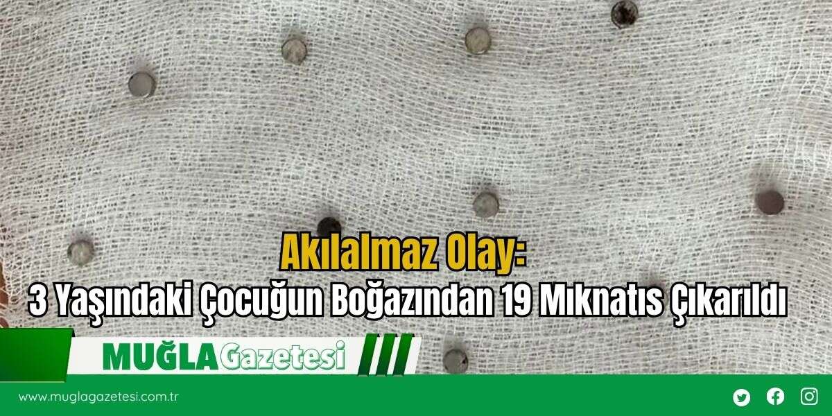 Akılalmaz Olay: 3 Yaşındaki Çocuğun Boğazından 19 Mıknatıs Çıkarıldı