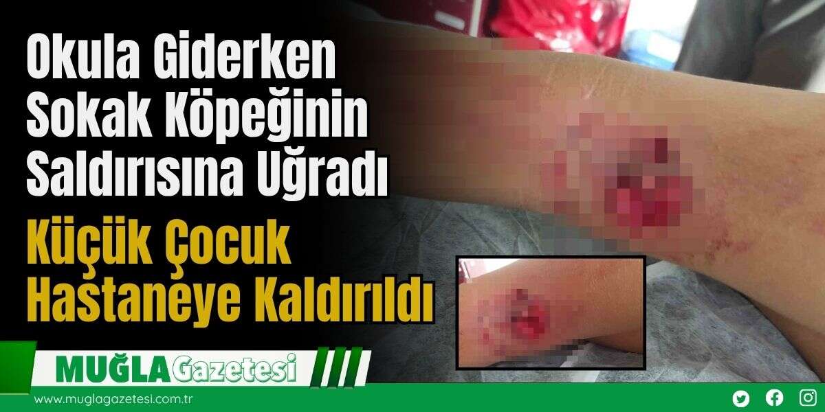 Okula Giderken Sokak Köpeğinin Saldırısına Uğradı: Küçük Çocuk Hastaneye Kaldırıldı
