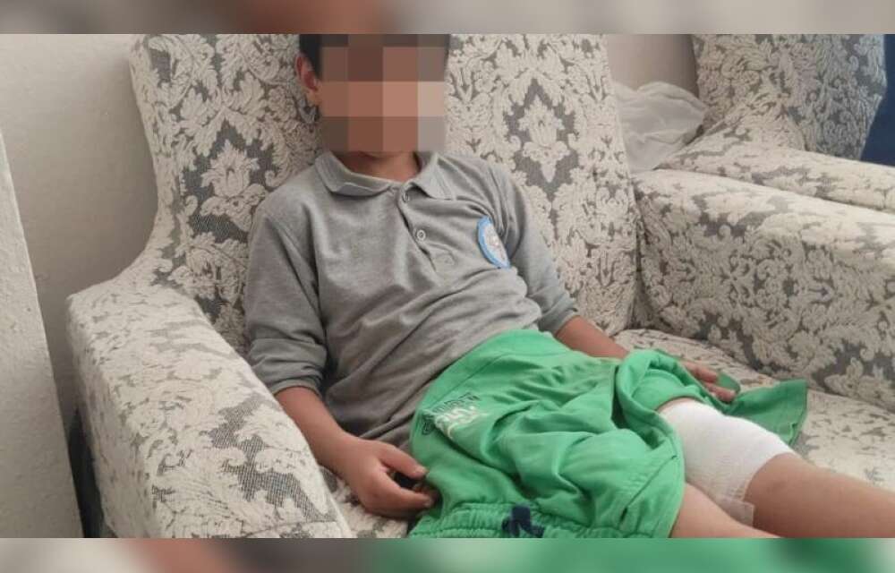 8 Yaşındaki Çocuğa Okul Yolunda Köpek Saldırdı