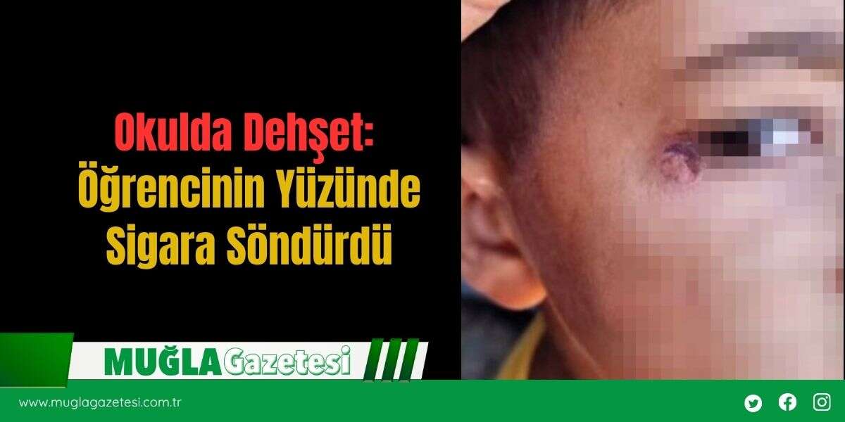 Okulda Dehşet: Öğrencinin Yüzünde Sigara Söndürdü