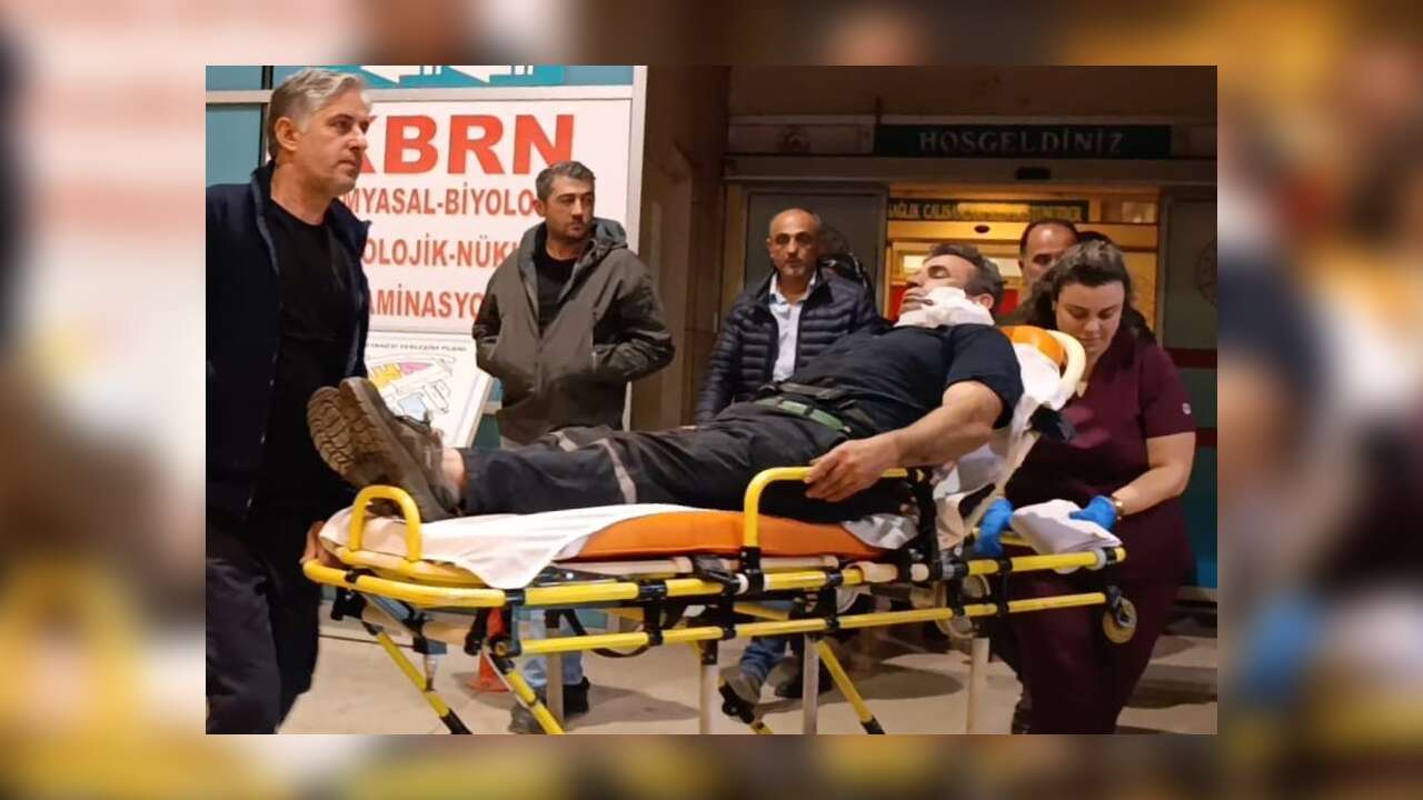 Kömürleri İndirirken Yüzüne Demir Saplandı