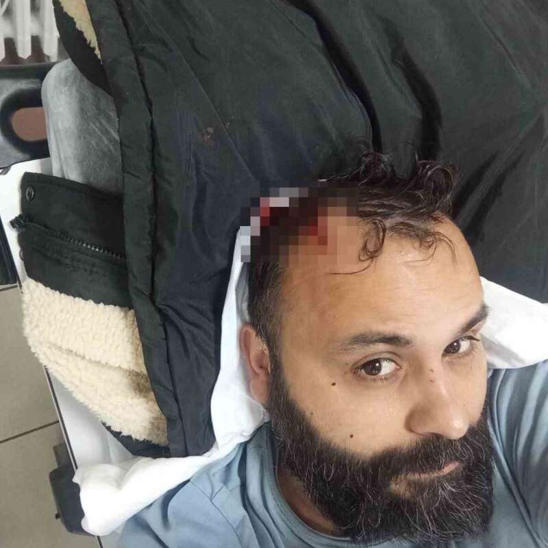 Sosyal Medya Fenomeni Boşanma Aşamasındaki Eşi ve Ailesi Tarafından Darbedildi