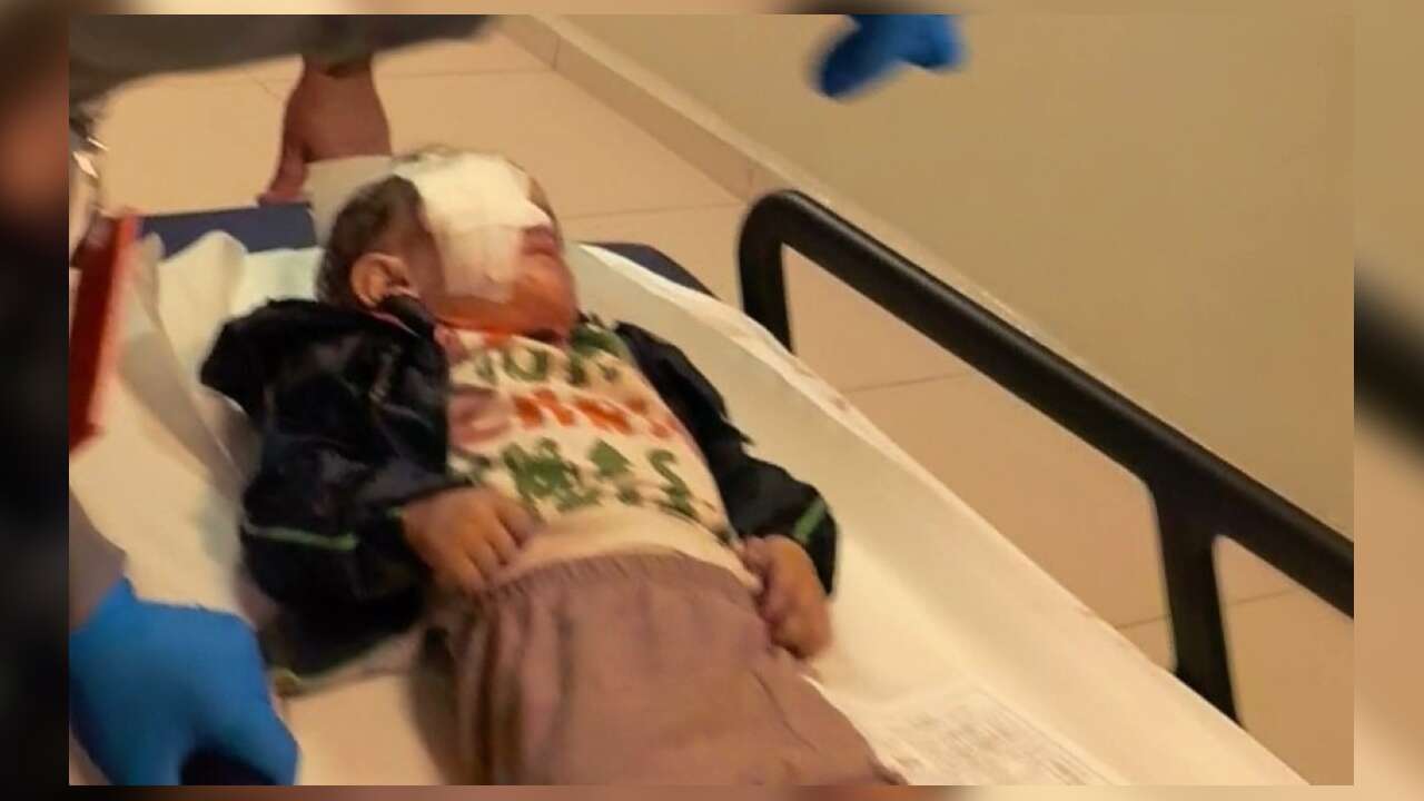 Bakkaldan Aldığı Torpil Minik Çocuğun Sağ Gözüne İsabet Etti