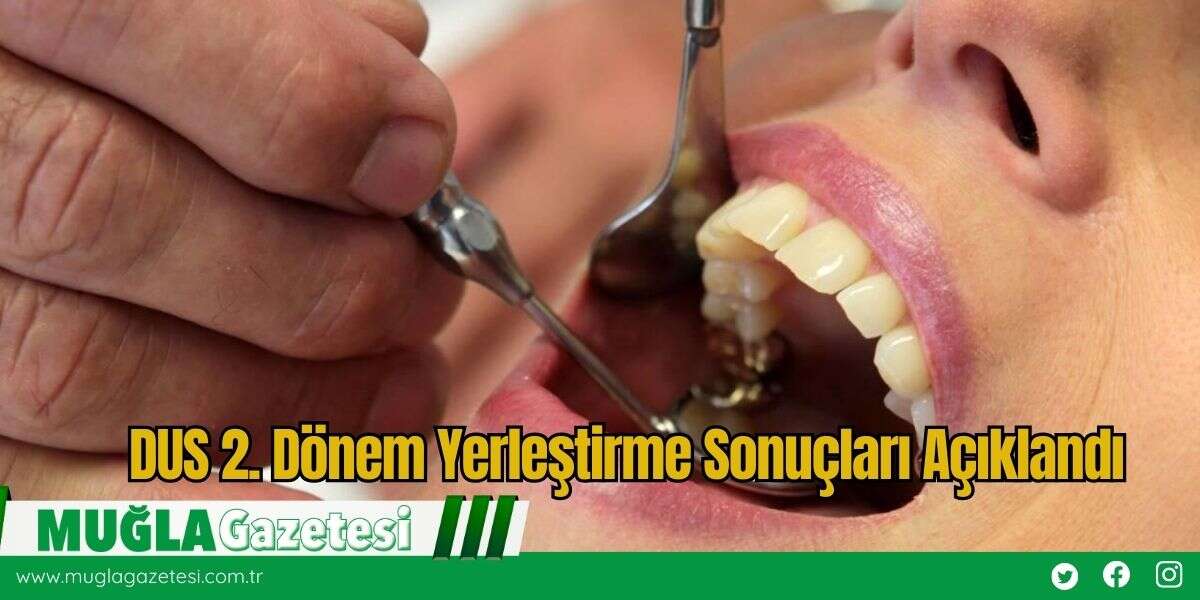 DUS 2. Dönem Yerleştirme Sonuçları Açıklandı