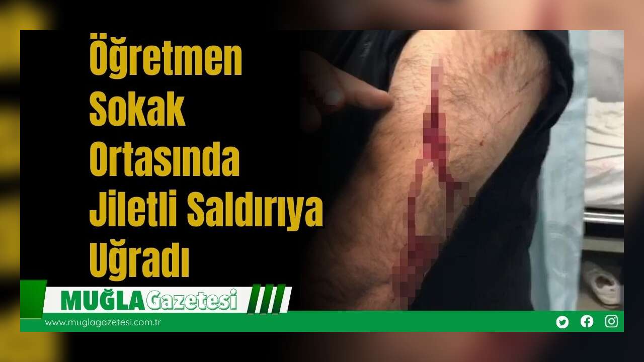 Öğretmen Sokak Ortasında Jiletli Saldırıya Uğradı